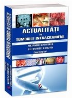 Actualitati in tumorile intracraniene