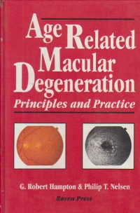 Age Related Macular Degeneration - Principles and Practice