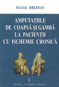 Amputatiile de coapsa si gamba la pacientii cu ischemie cronica (CD-ROM inclus)
