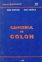 Cancerul de colon