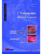 Colposcopia : tehnică şi diagnostic