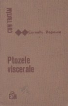 Cum tratam ptozele viscerale