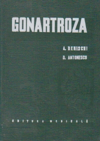 Gonartroza