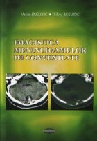 Imagistica meningioamelor de convexitate