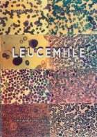 Leucemiile