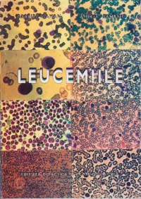 Leucemiile