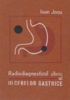 Radiodiagnosticul clinic ulcerelor gastrice