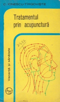 Tratamentul prin acupuntura